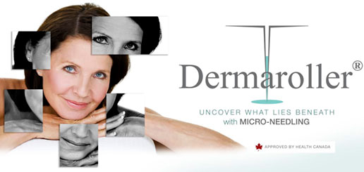 Dermaroller Micro-Needling