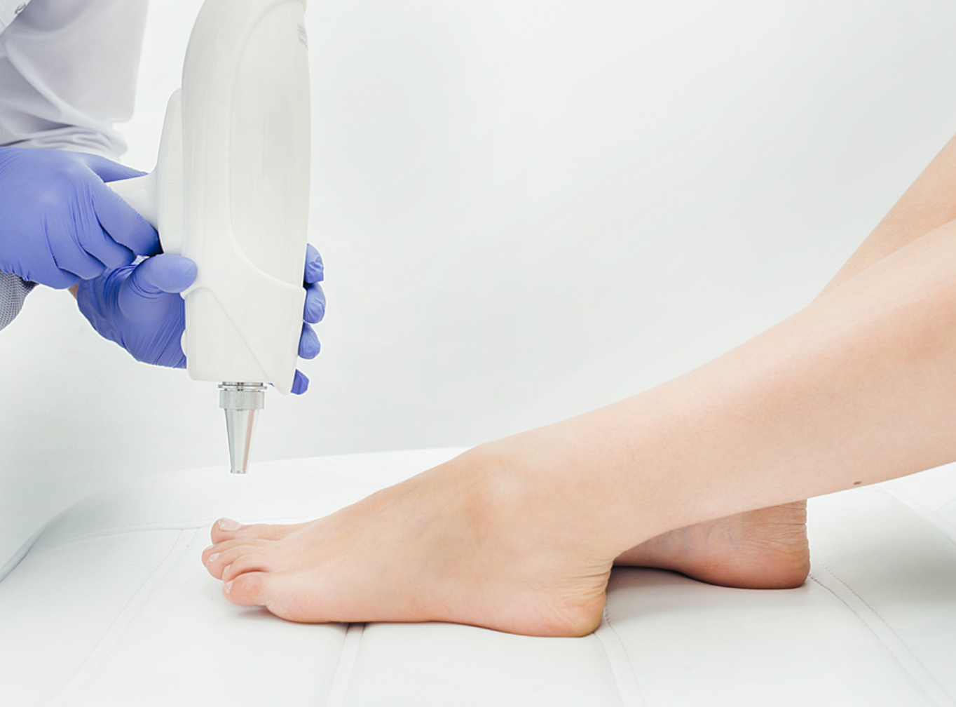 Nail Fungus Treatment