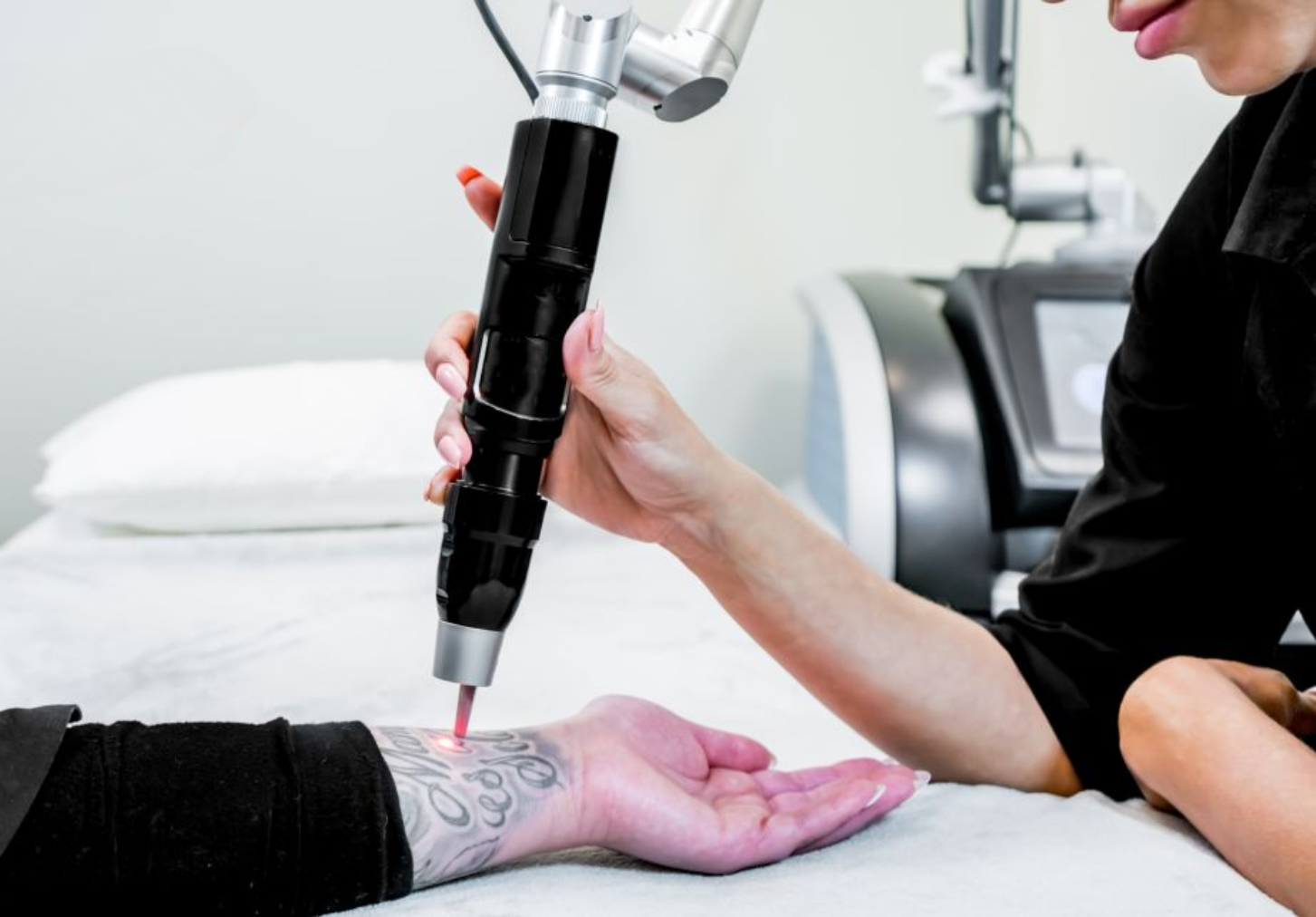 Laser Tattoo Removal with PicoSure Pro