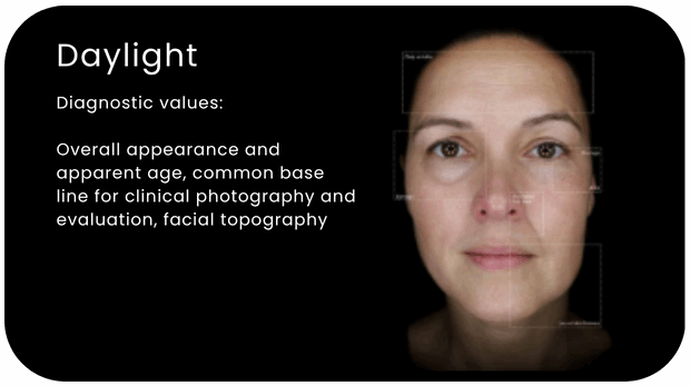 Alma IQ Daylight