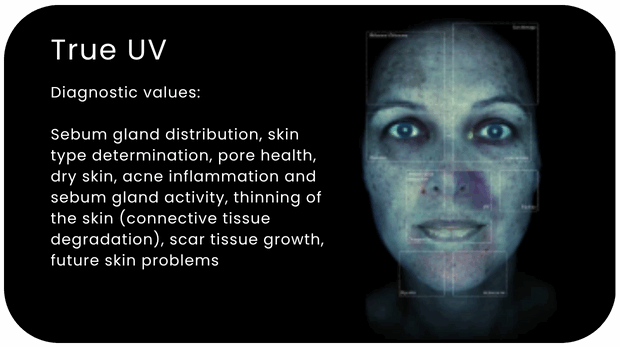 Alma IQ True UV