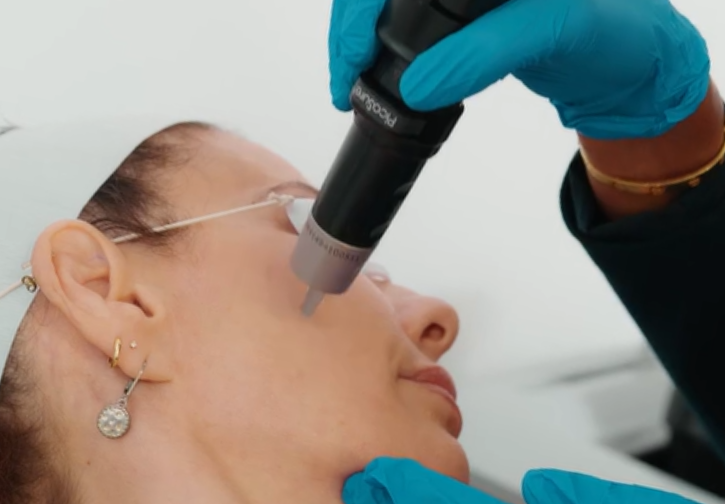 PicoSure
