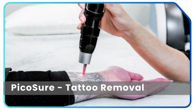 PicoSure Tattoo Removal