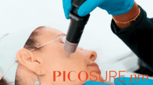 PicoSure