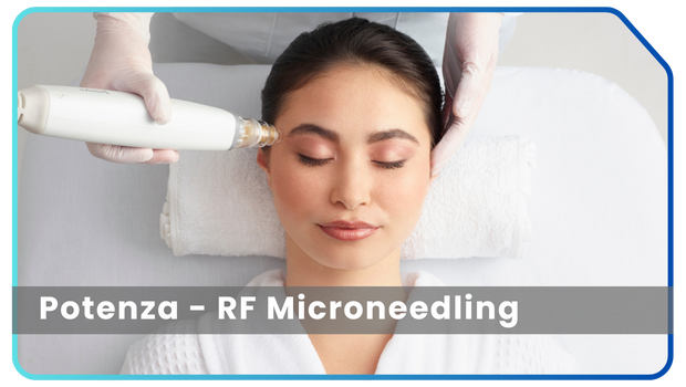 Potenza RF Microneedling