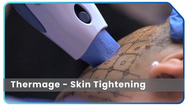 Thermage
