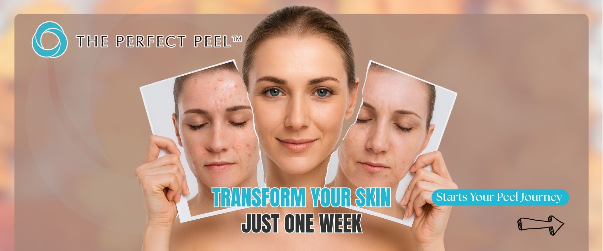 Perfect Peel Perfect Peel