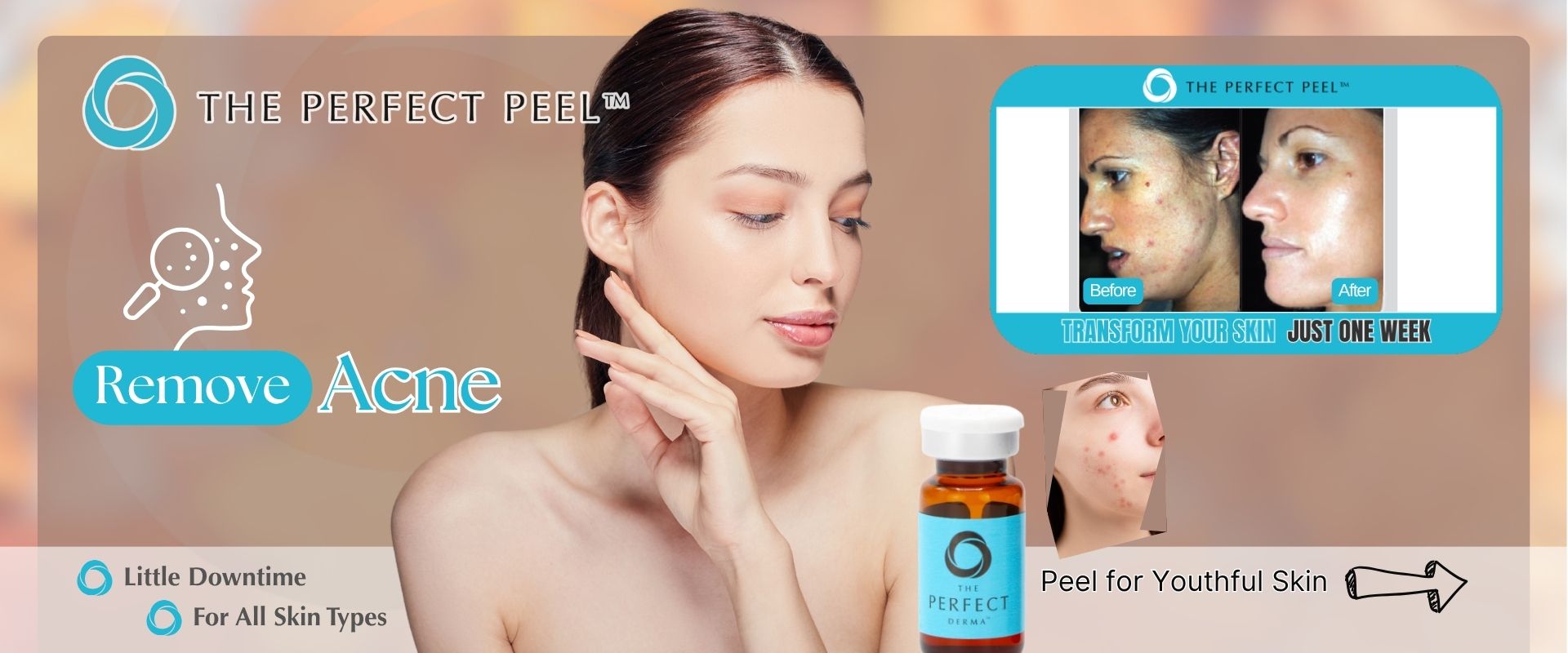 Perfect Peel Acne Perfect Peel Acne