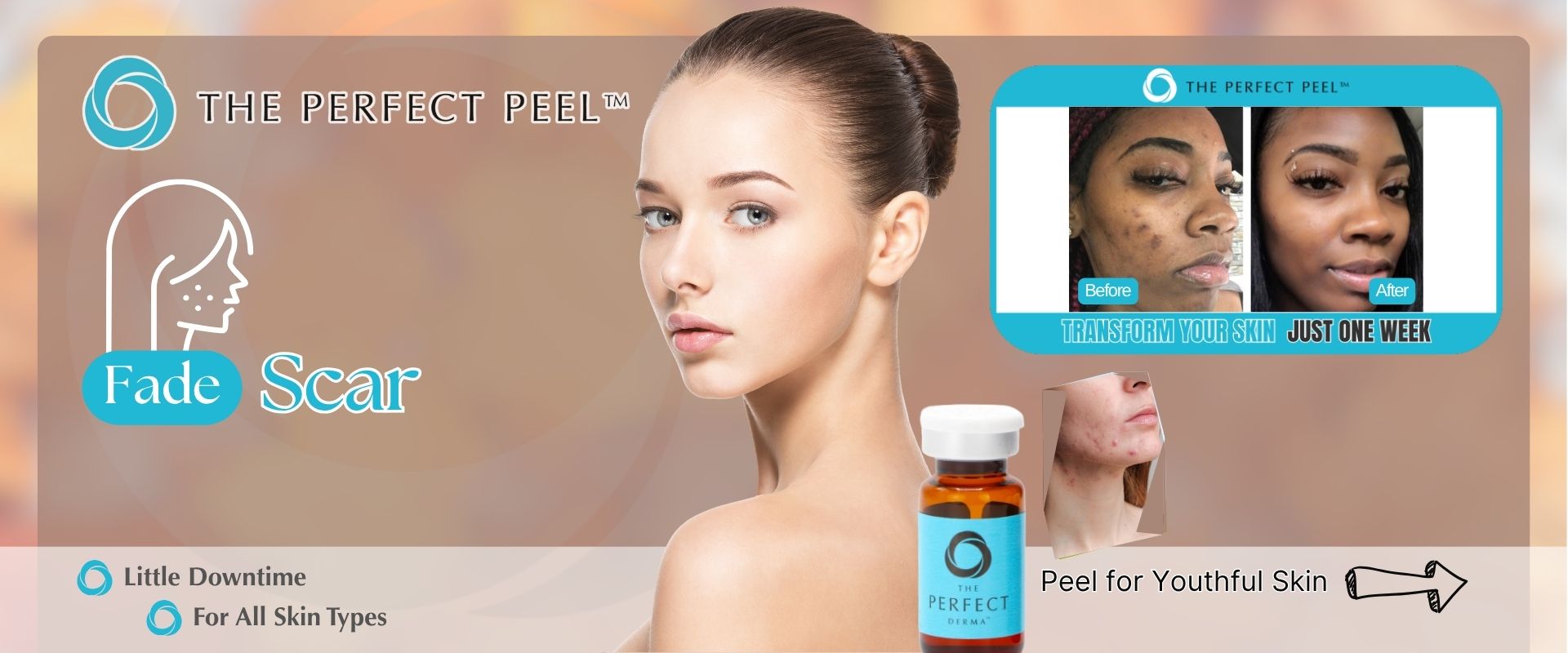 Perfect Peel Scar Perfect Peel Scar