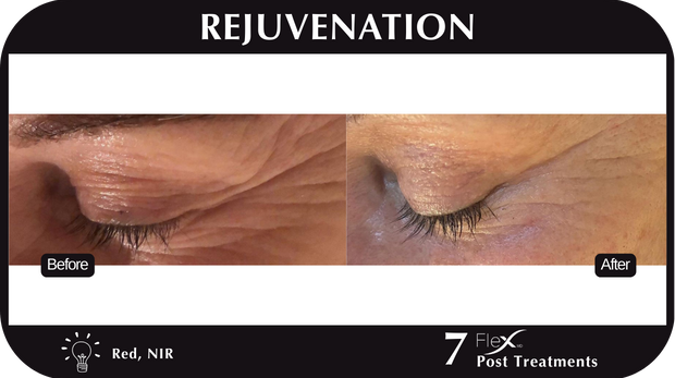 Flex MD Rejuvenation
