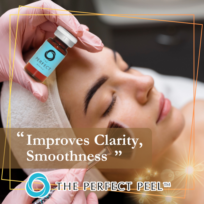 Perfect Peel